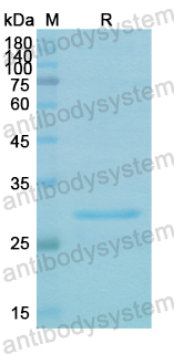 Recombinant Human PRKAB2 Protein, N-His