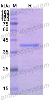 Recombinant Human NARS1 Protein, N-His