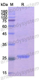 Recombinant Human SCO2 Protein, N-His