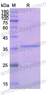 Recombinant Human CALU Protein, N-His