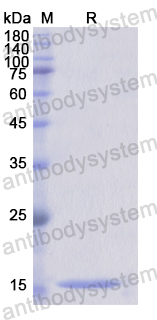 Recombinant Human CD5L Protein, N-His