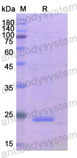 Recombinant Human GAS2 Protein, N-His