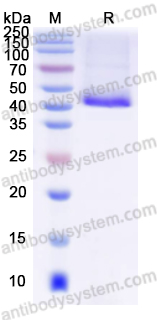 Recombinant Human VEGFD Protein, N-His