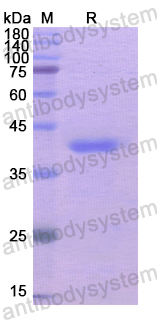 Recombinant Human AKR1B10 Protein, N-His