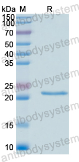 Recombinant Human TIMM8A Protein, N-His-SUMO