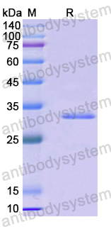 Recombinant Human SH3BP5 Protein, N-His