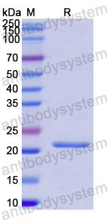 Recombinant Human FGF17 Protein, N-His