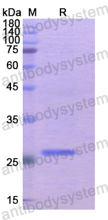 Recombinant Human KLK8 Protein, N-His