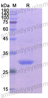 Recombinant Human PRKN Protein, N-His