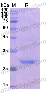 Recombinant Human ADCY3 Protein, N-His