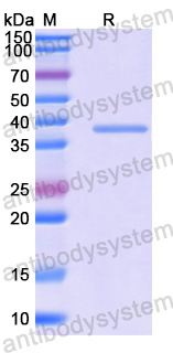 Recombinant Human KIF5C Protein, N-His