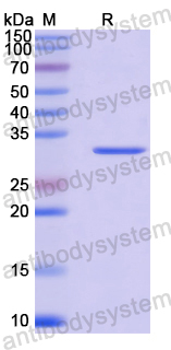 Recombinant Human TRAK2 Protein, N-His