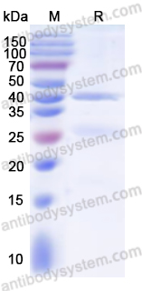 Recombinant Human OPA1 Protein, N-His