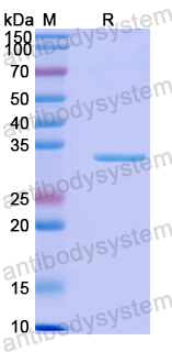 Recombinant Human KIF1B Protein, N-His