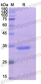 Recombinant Human PPL Protein, N-His