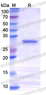 Recombinant Human GSDME Protein, N-His