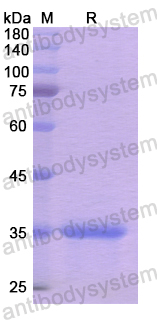 Recombinant Human CD205/LY75 Protein, N-His