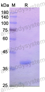 Recombinant Human CD232/PLXNC1 Protein, N-His