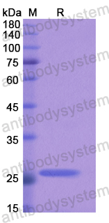 Recombinant Human ACSL4 Protein, N-His