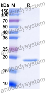 Recombinant Human SNX3 Protein, C-His