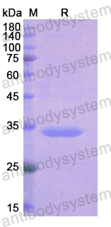 Recombinant Human NPHS1 Protein, N-His