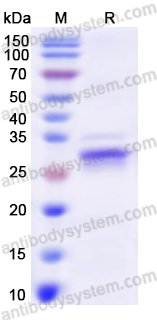 Recombinant Human ADCY9 Protein, N-His