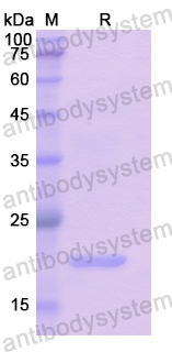 Recombinant Human GREM1 Protein, N-His