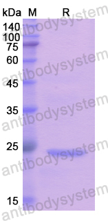 Recombinant Human DIAPH1 Protein, N-His