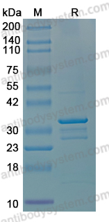 Recombinant Human TSPAN1 Protein, N-GST