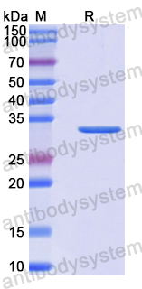 Recombinant Human RAD1 Protein, N-His