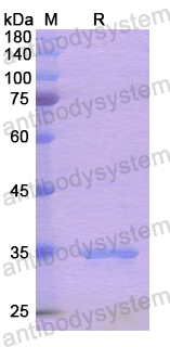 Recombinant Human JAK2 Protein, N-His