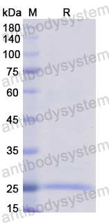 Recombinant Human PLA2G6 Protein, N-His