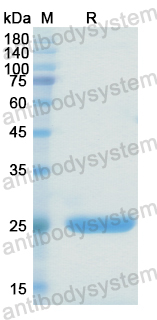 Recombinant Human HPGDS Protein, N-His