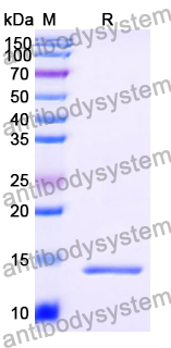 Recombinant Human CCDC22 Protein, N-His