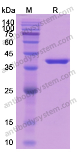 Recombinant Human PQBP1 Protein, N-His