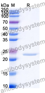 Recombinant Human OPHN1 Protein, N-His