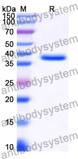 Recombinant Human RAMP1 Protein, N-GST & C-His