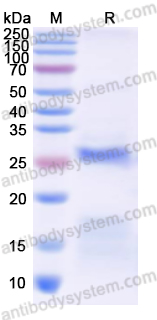 Recombinant Human SMPD2 Protein, N-His