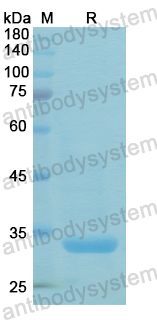 Recombinant Human CTSV Protein, N-His