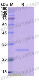 Recombinant Human DTNB Protein, N-His