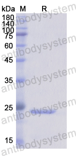 Recombinant Human CD16b/FCGR3B Protein, N-His