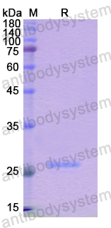 Recombinant Human NOS1AP Protein, N-His