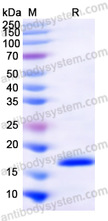 Recombinant Human SLIT3 Protein, N-His