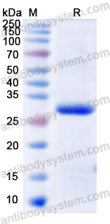 Recombinant Human SLIT3 Protein, N-His