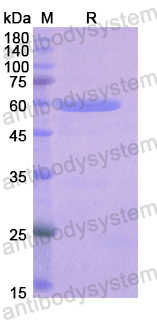 Recombinant Human LRP4 Protein, N-GST