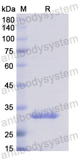 Recombinant Human AOC2 Protein, N-His