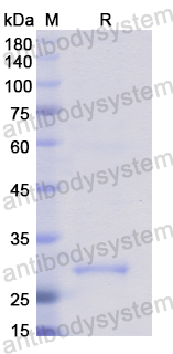 Recombinant Human ROCK2 Protein, N-His