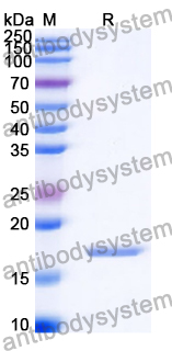 Recombinant Human ATG13 Protein, N-His