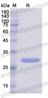 Recombinant Human HIP1R Protein, N-His