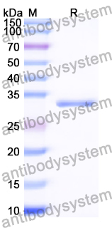 Recombinant Human RNF40 Protein, N-His